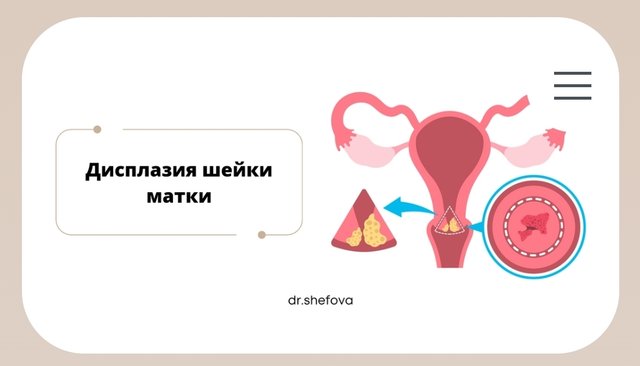 Дисплазия.jpg