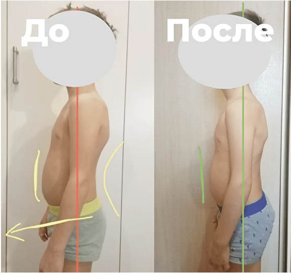 осанка 2.jpg