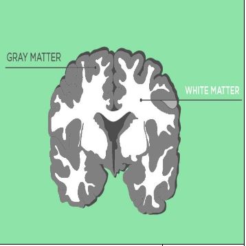 White Matter.JPG